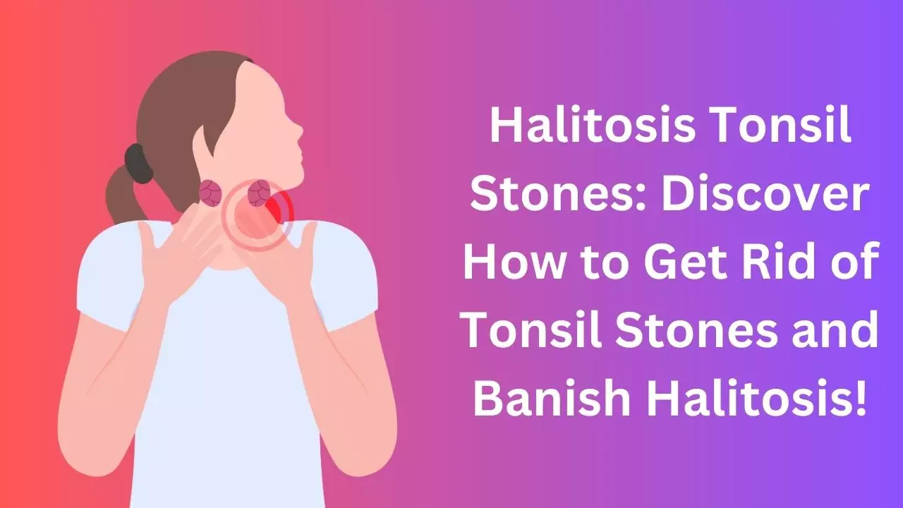 Halitosis Tonsil Stones