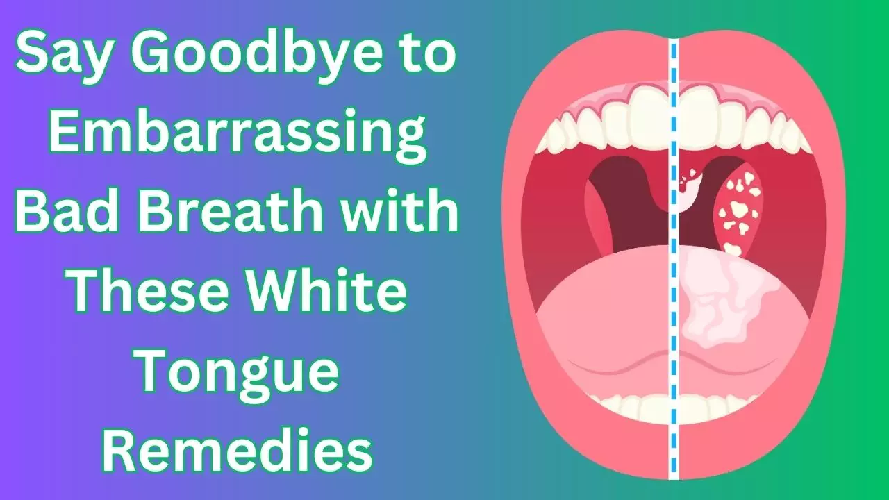 Bad Breath and White Tongue Remedies