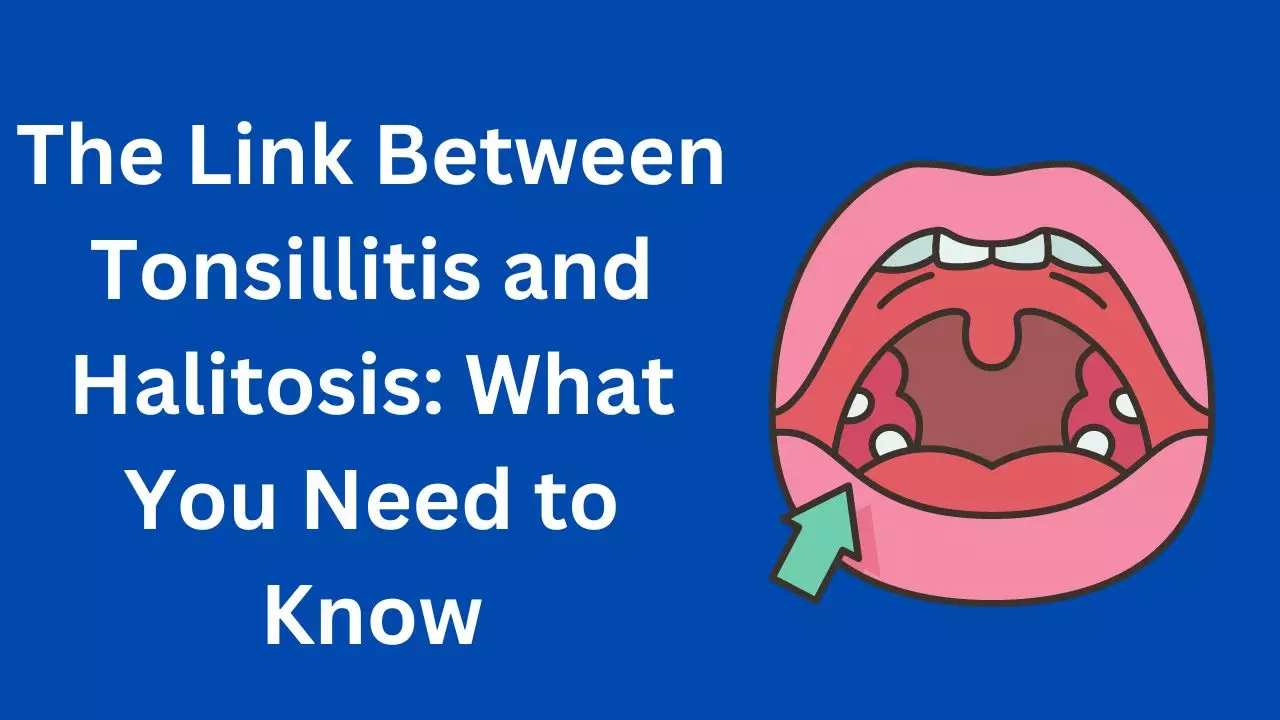 Tonsillitis and Halitosis