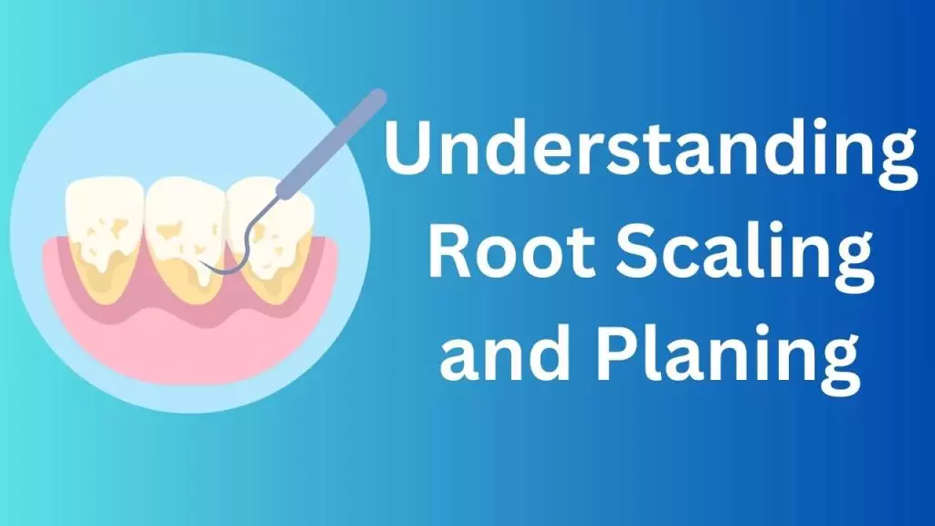 Root Scaling and Planing