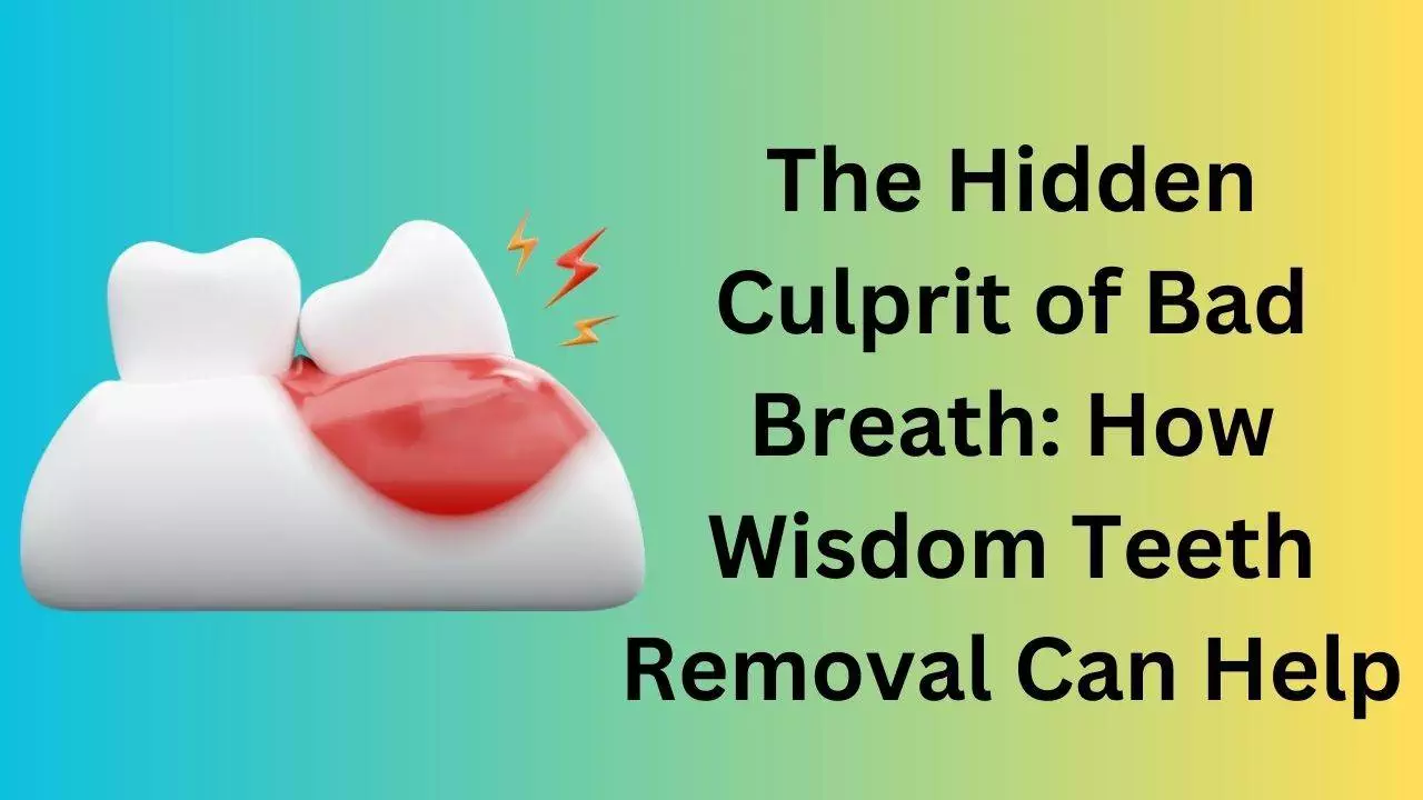 Bad Breath Wisdom Teeth Removal