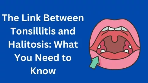 Tonsillitis and Halitosis